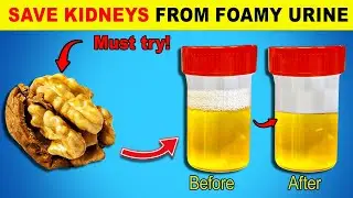 Top 6 Super Foods To Help Stop Proteinuria and Heal Your Kidneys | Healthy Every Day