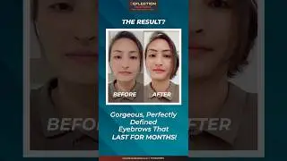 Achieve Perfect Brows with Microblading | Reflection Facethetics #shorts