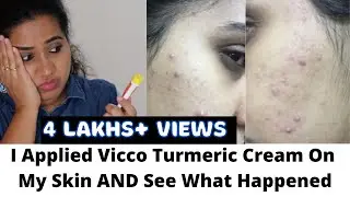 ❌🔴 I Applied Vicco Turmeric On My Skin & See What Happened | Side Effects Of Vicco Turmeric Cream