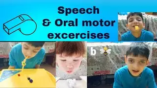 Speech and oral motor activities for CP/Autistic/ Speech delayed child