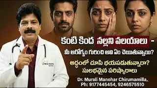 కంటి కింద నల్లని వలయాలు  మీ ఆరోగ్యం గురించి అవి ఏం చెబుతున్నాయి? Dark circles under the eyes problem