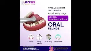 Dental Fillings Treatment Clinic in KPHB | Call: 9032802805 | Best Dental Clinic in KPHB