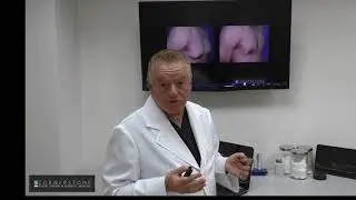 Gynecomastia- Male Breast (Enlarged Breast Gland)