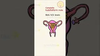 OBGYN USMLE Step 1&2 #usmle #neetpg #neet #usmlepreparation #viralshorts #viralvideo #viralreels