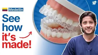 Clear Aligners in Medellin: Invisalign Treatment Explained by Colombia's Top Orthodontist