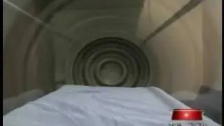Traumatic Brain Injury Responds to Hyperbaric Oxygen Therapy