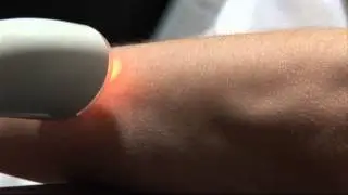 UmbanBEAUTY RIO Laser