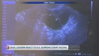 Pro-life, pro-choice leaders in Arkansas react to Supreme Court ruling on abortion pills