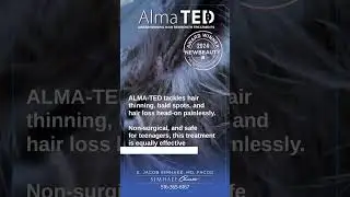 Alma TED Non Invasive Hair Regrowth Treatments with Dr Simhaee, Manhasset, Long Island, New York