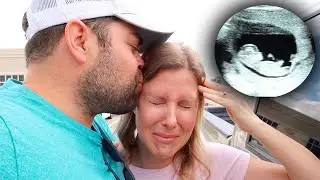 EMOTIONAL 10 WEEK ULTRASOUND!