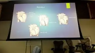 EKG (8JAN)
