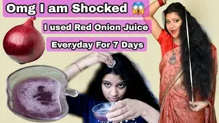 Omg 😱 I Used Red Onion Juice Everyday For 7 Days & This Is What Happened/ Onion Juice For 7 Days