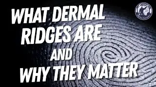 What Dermal Ridges Are and Why They Matter