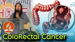 How to AVOID Colon Cancer !!!