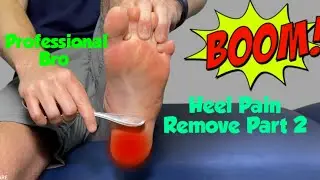Heel Pain Remove Exercise //Heel pain Treatment /Follow This Tips