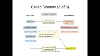 Pediatric Digestive Disorders Explained: Cleft Lip, GERD, Hirschsprung Disease, and Celiac Disease