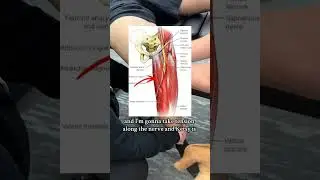 Fixing knee pain by working on an entrapped Saphenous nerve #adhesionrelease #kneepain