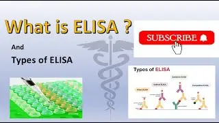 What is ELISA | Types of ELISA | Direct, Indirect, Sandwich, Competitive, Reverse ELISA | Syllabusme