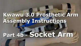 4b Assembling Socket Arm | Kwawu 3.0 Prosthetic Arm Assembly Instructions