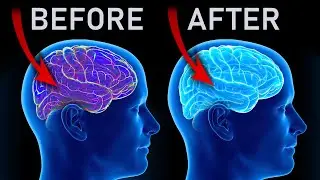LISTEN BEFORE BED To Calm Your Busy Brain ❯❯❯ MELATONIN Inducing Theta Waves &bull; 4Hz Sleep Remedy