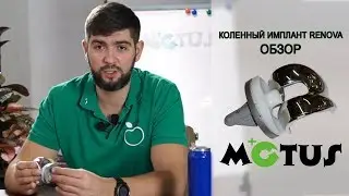 МОТУС ТЕСТ #10 | КОЛЕННЫЙ ИМПЛАНТ RENOVA