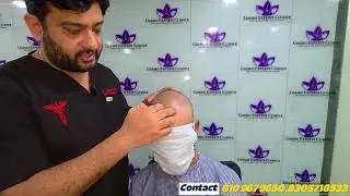 Hair Transplant Patient Review | No Filter,RealTalk | Cosmo Experts Clinics |