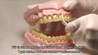 Tandtr&aring;d