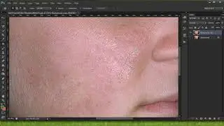 How to remove Pimples from the face using Photoshop