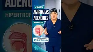 Cirug&iacute;a de ADENOIDES y Tabique - Adios ronquido #hipertrofia #amigdalas