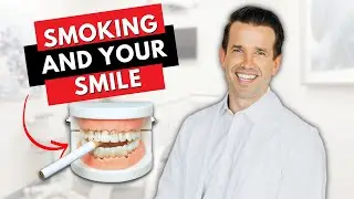 Can a Dentist Tell if you SMOKE 🚬 | Dr. Nate