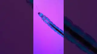dancing insect larva #science #microscope #womeninstem #biology #stem #insects