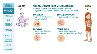 Differences between Enanthem and exanthem (Rashes or Lesions)