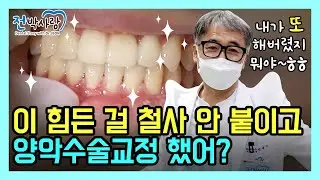 1-58. ⭐양악수술+치아교정⭐철사 안붙이고 치료하는 방법❗ 내가 또 해버렸지 뭐야~