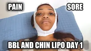 SURGERY DAY!!!!! *BBL & CHIN LIPO*