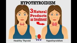 Hypothyroidism, 3 Natural Remedies for as treatment