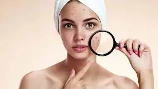 Best Acne Facial Treatment in Orange County - About Skin in Lake Forest