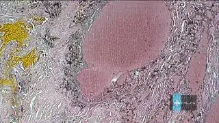 Panasonic GP-KH232 Attached to a biological microscope