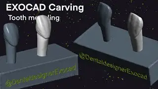 Exocad Carving I Tooth Modeling 28