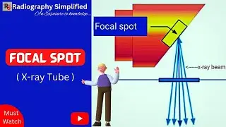Focal Spot in an x-ray tube  ll Effective & Actual focal spot   ll Radiography Simplified