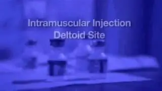 IM Deltoid FINAL