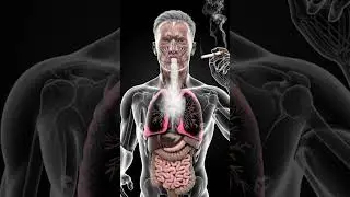 The Physiological Impact of Smoking: A 3D Medical Visualization of Lung Damage