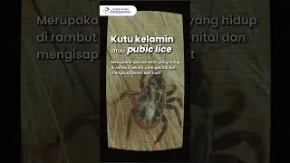 Gatal di Area Kelamin Susah Sembuh? Waspada, Kutu Kelamin!