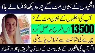 Face Recognition for BISP Beneficiaries with Erased Fingerprints