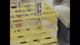 Induction of Alloantigen-specific Anergy in Human Peripheral Blood Mononuclear Cells by Alloantigen