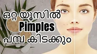 Thamanas  Pimples Remove technique #pimpleremoval #skincare #skincaretips 
