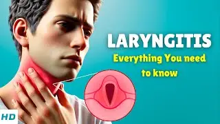 Laryngitis (Losing Your Voice) &ndash; Causes, Signs and Symptoms, Diagnosis & Treatment
