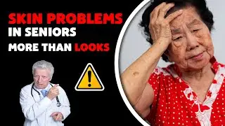 Itchy Skin After 60? It&rsquo;s Not Just About Looks &ndash; Senior Health Warning