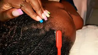 Tingly ASMR Hairline Scratching and Nitpicking #asmr #relaxing #asmrsounds