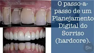 Tutorial de Planejamento digital do Sorriso [em um caso hardcore]