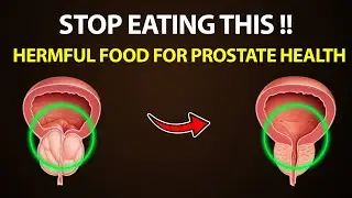 Stop Eating These 5 Common Foods If You Want to Shrink Your Prostate and Regain Control Your Bladder
